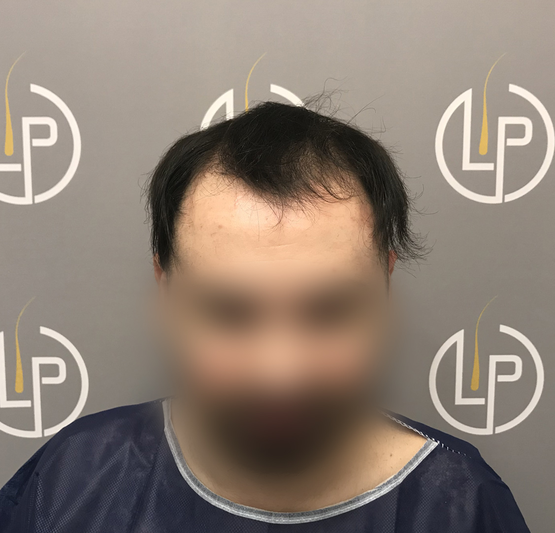 After