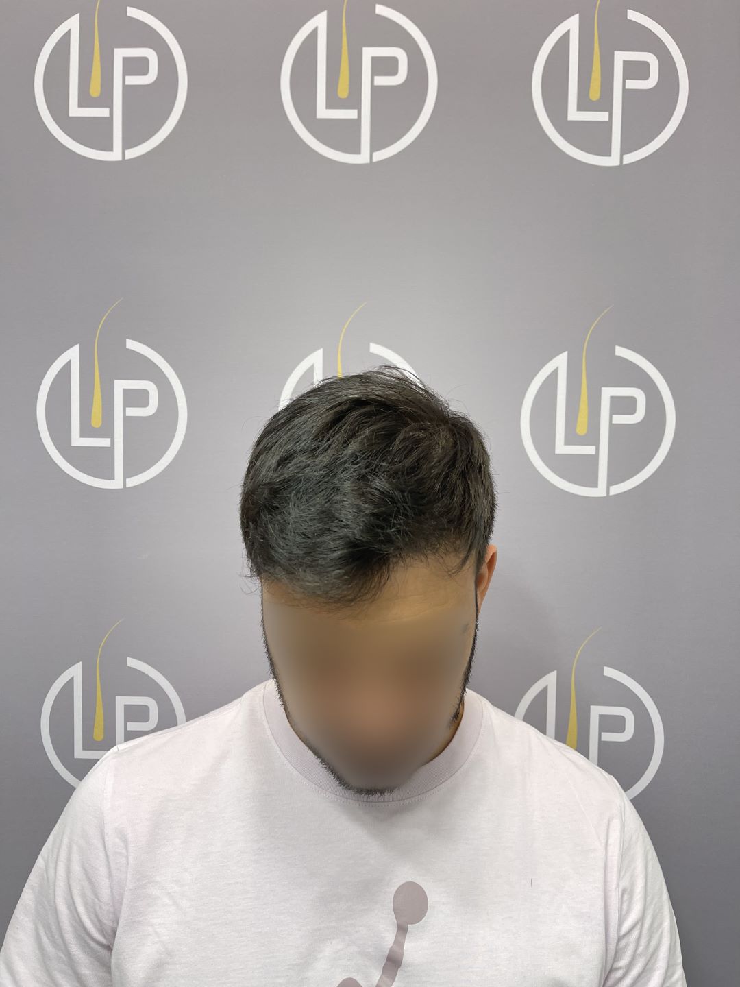 After