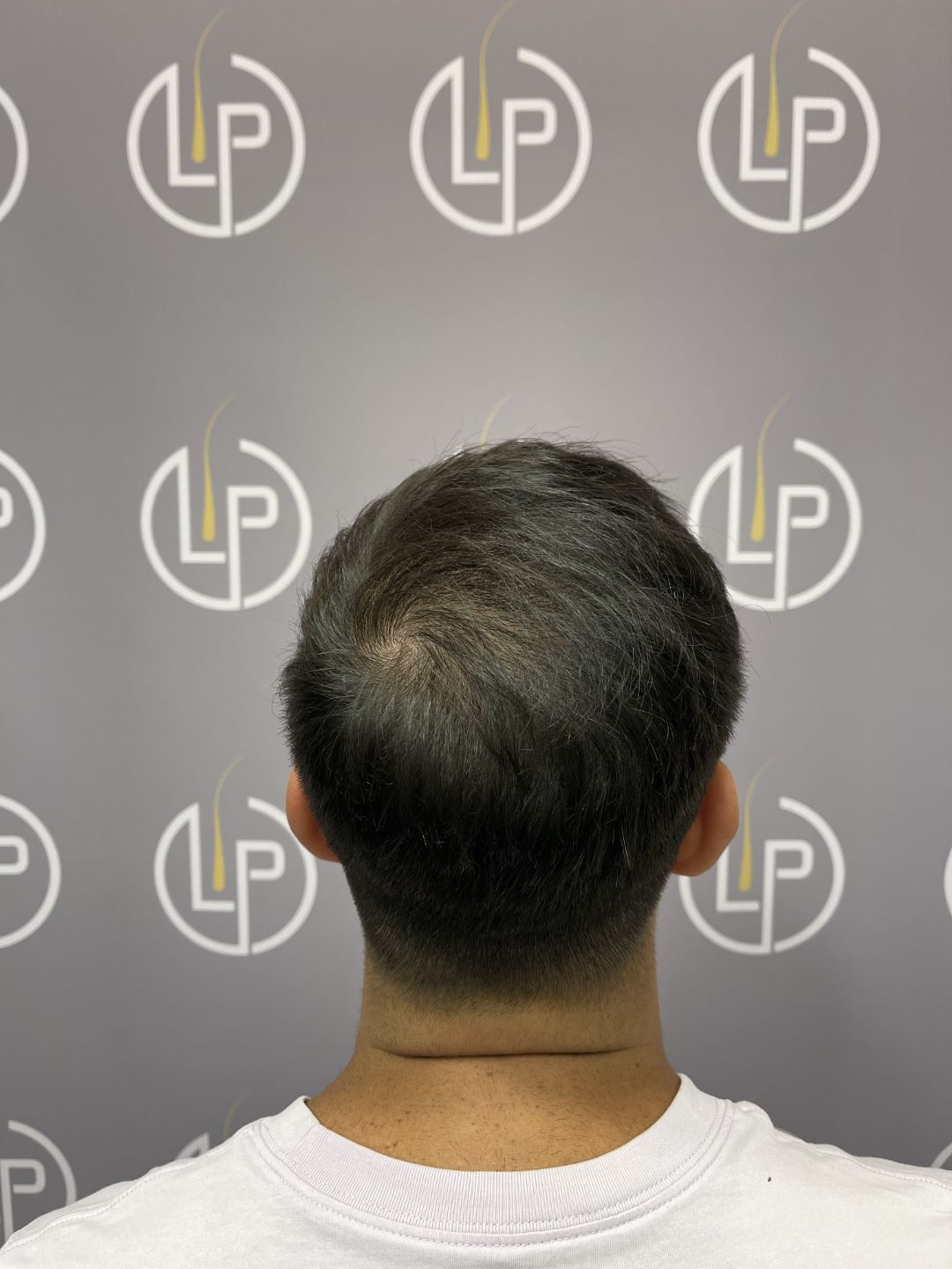 Before