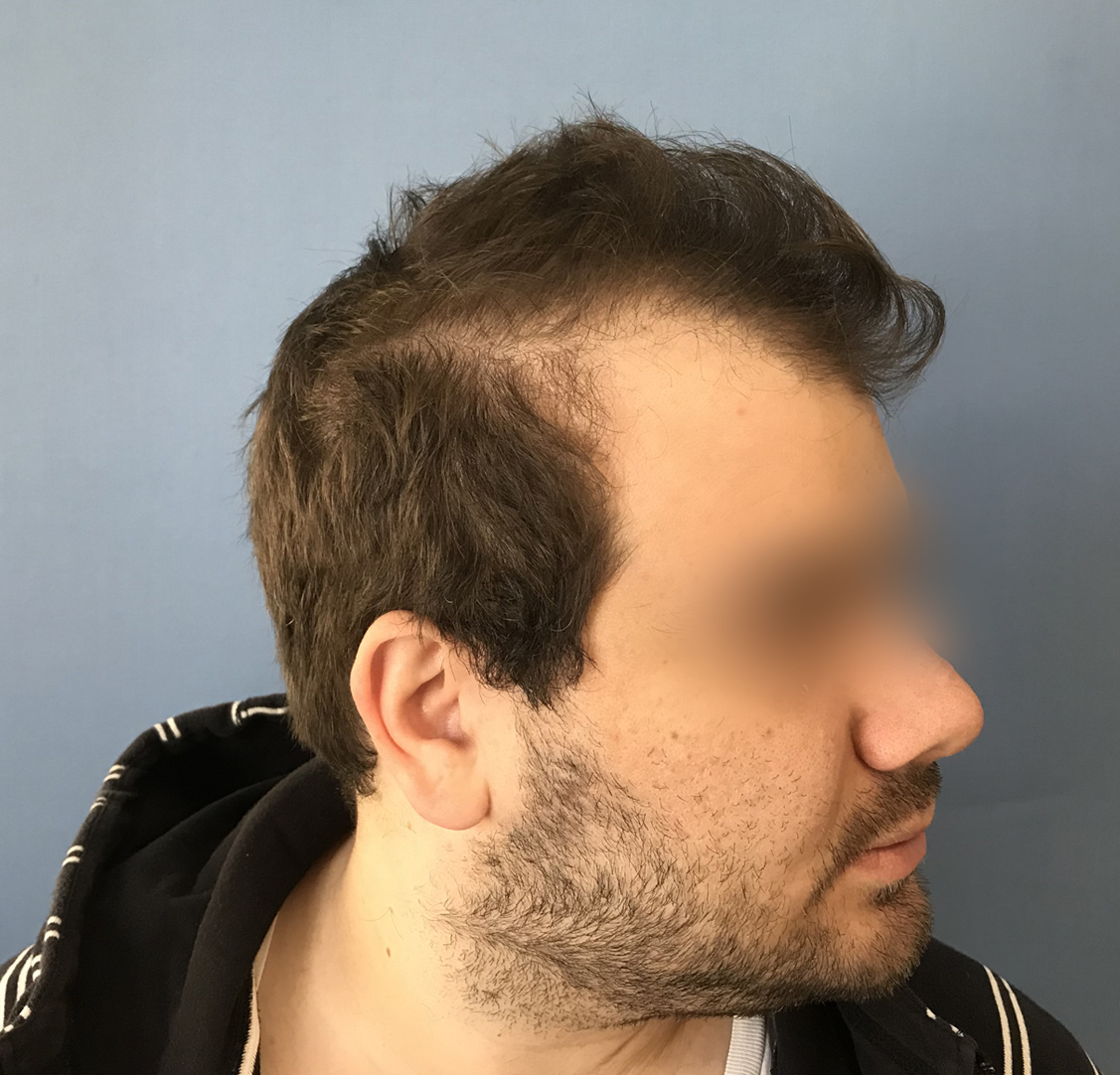 After