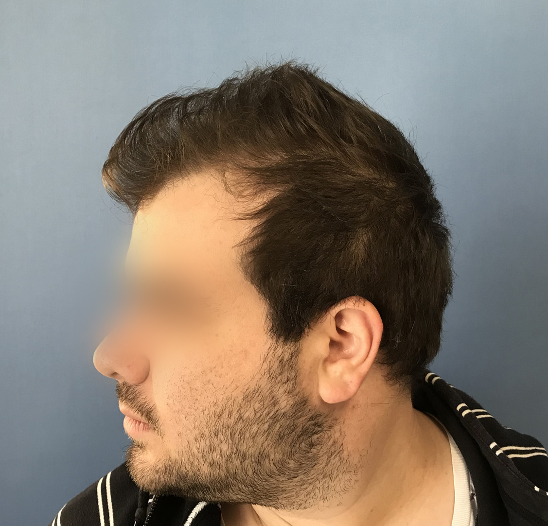 After