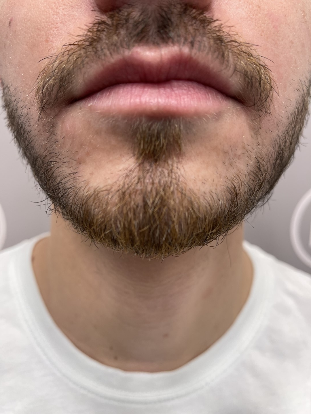 Before